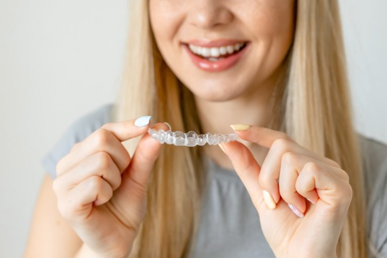 What Are DIY Clear Aligners? Indian Trail Dental Studio