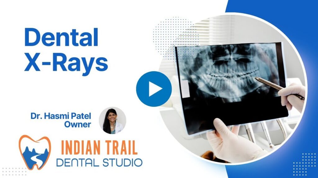 dental x-rays