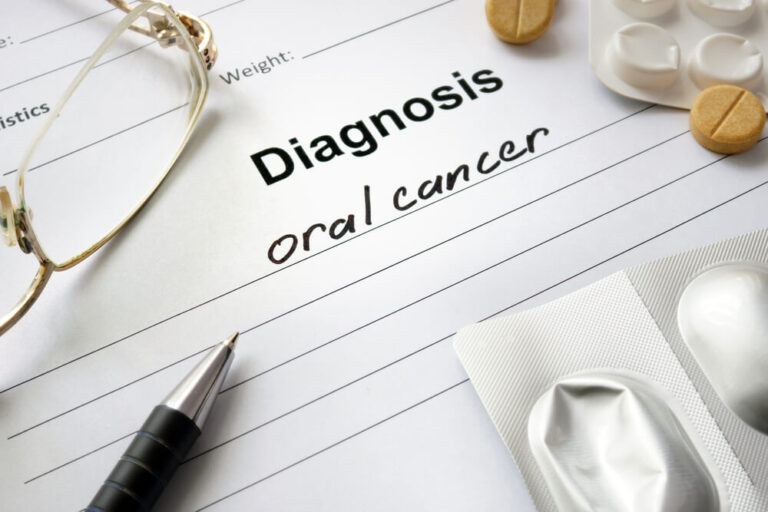 how-fast-does-oral-cancer-spread