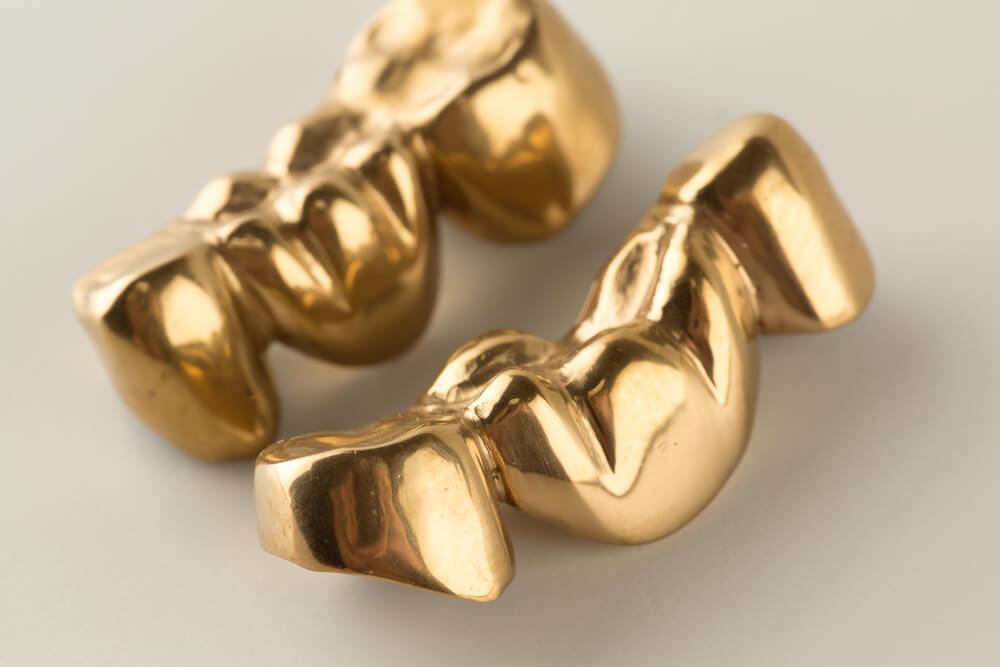 metal dental crowns