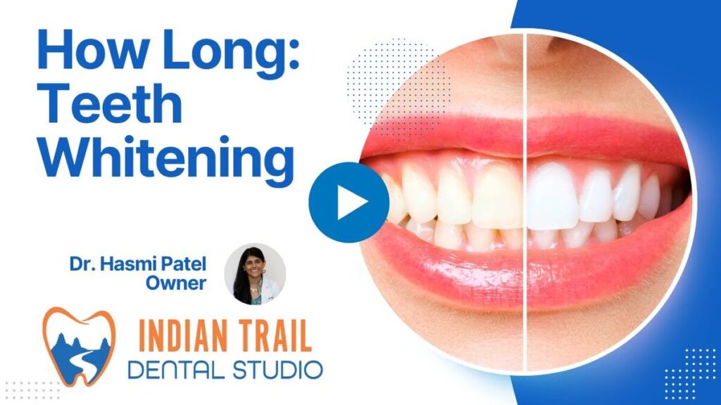 teeth whitening last
