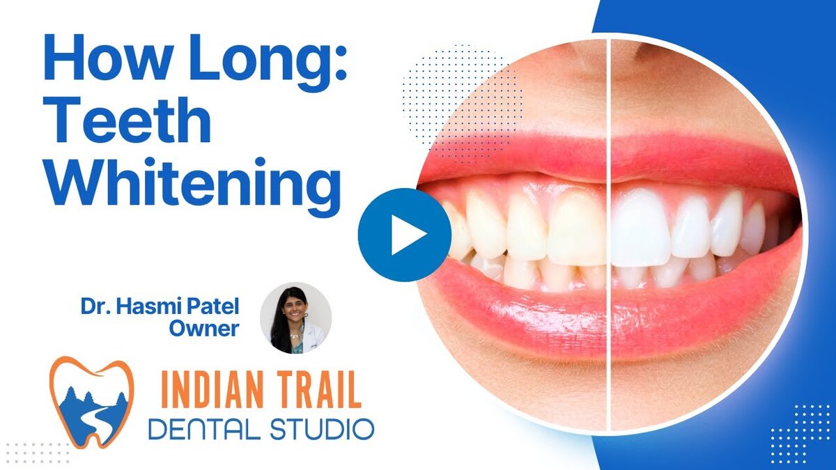 teeth whitening last
