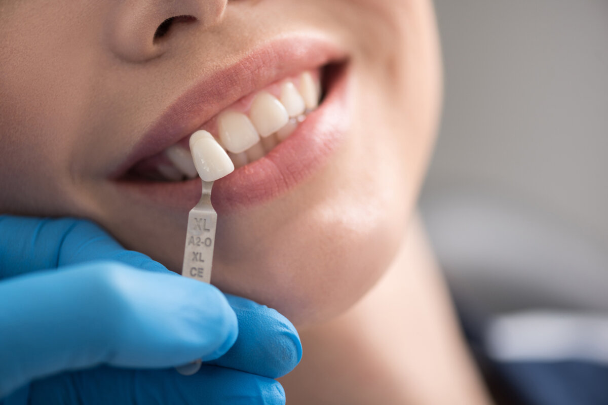 dental implants necessary