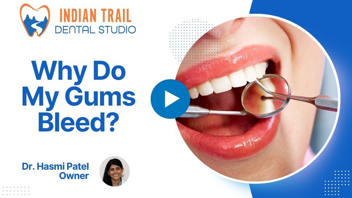 gums bleed