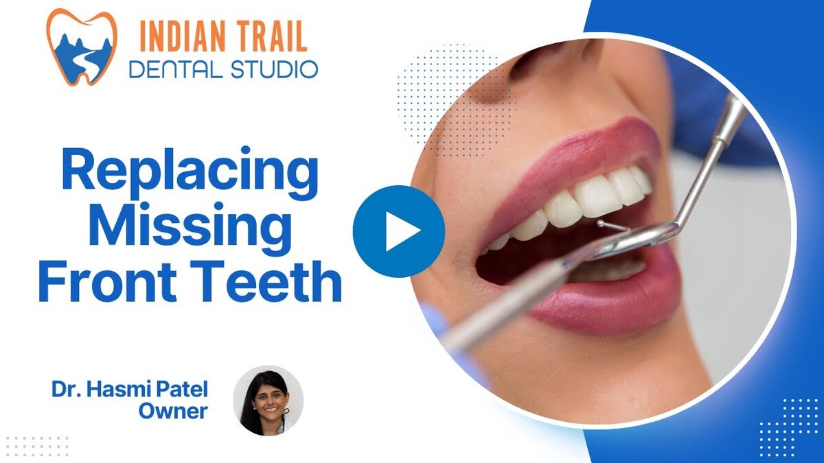replacing missing front teeth