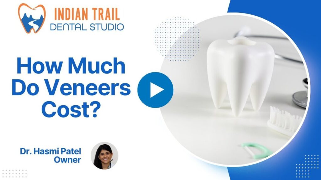 dental veneers cost