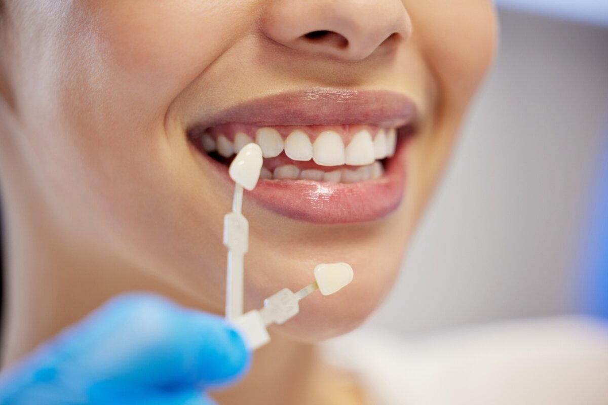 minimize teeth sensitivity whitening