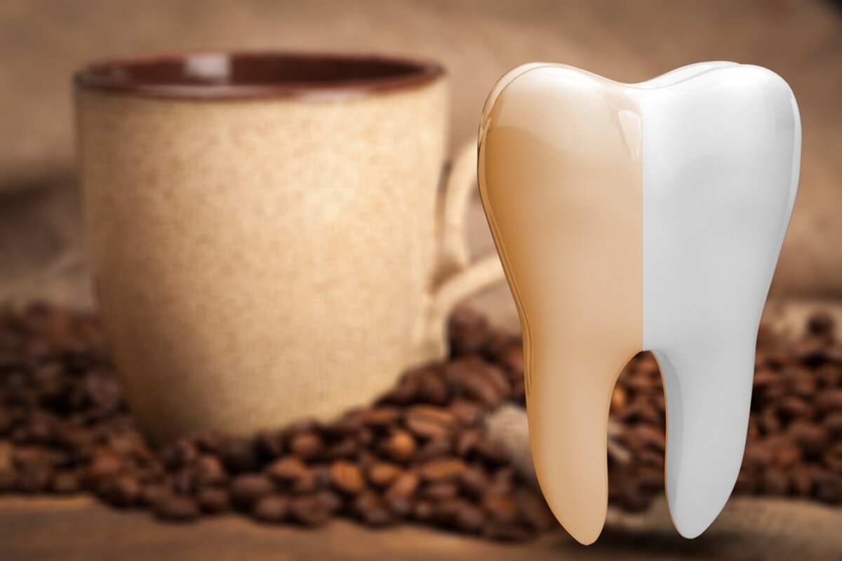 get rid of coffee stains on teeth