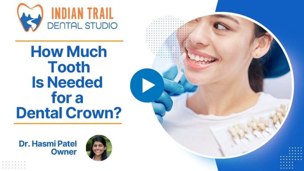how much tooth is needed for a dental crown