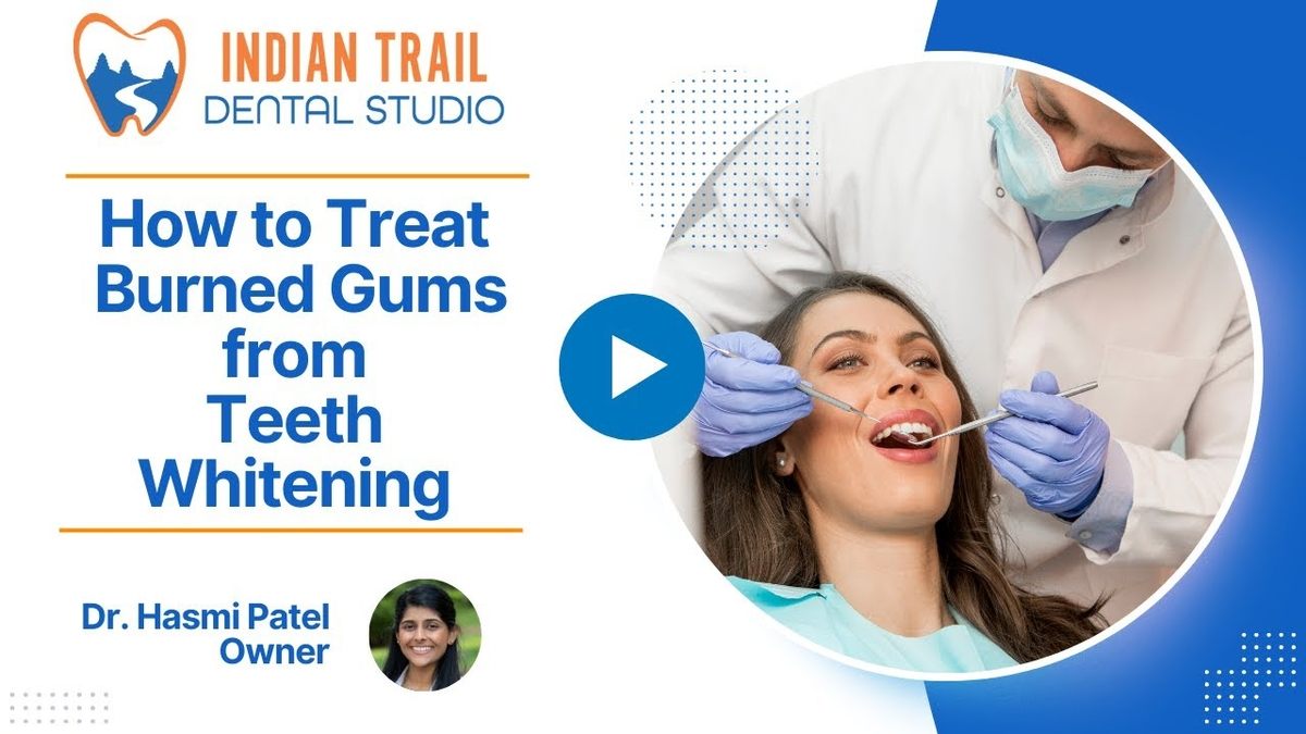 How to Treat Burned Gums from Teeth Whitening
