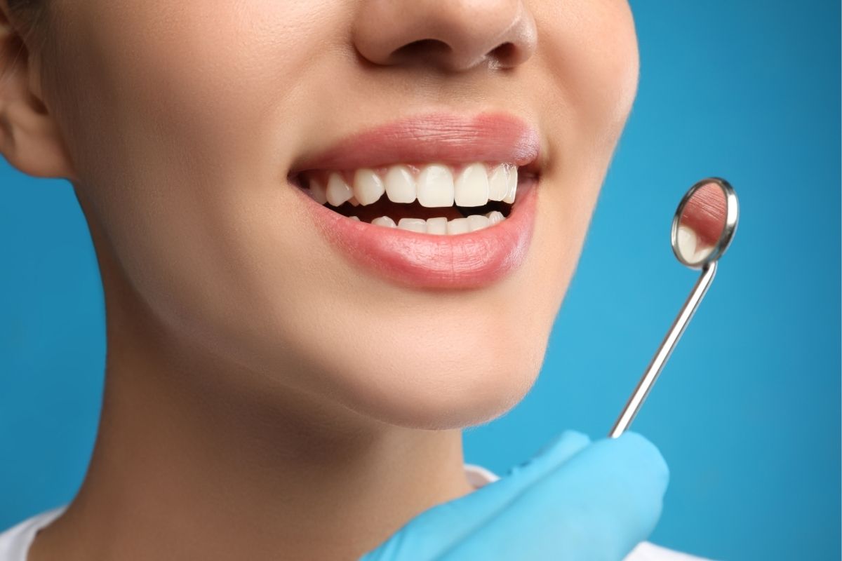 How Composite Bonding Fixes Gaps, Chips, and Discoloration