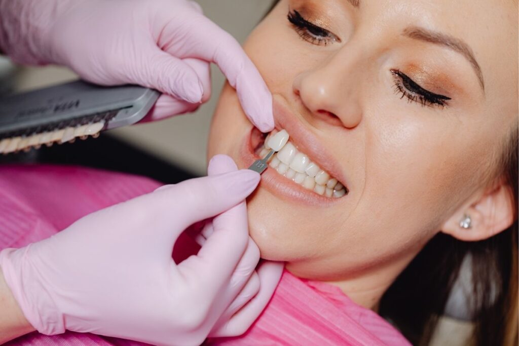 Veneers vs. Bonding: What’s Best for Chipped Front Teeth?
