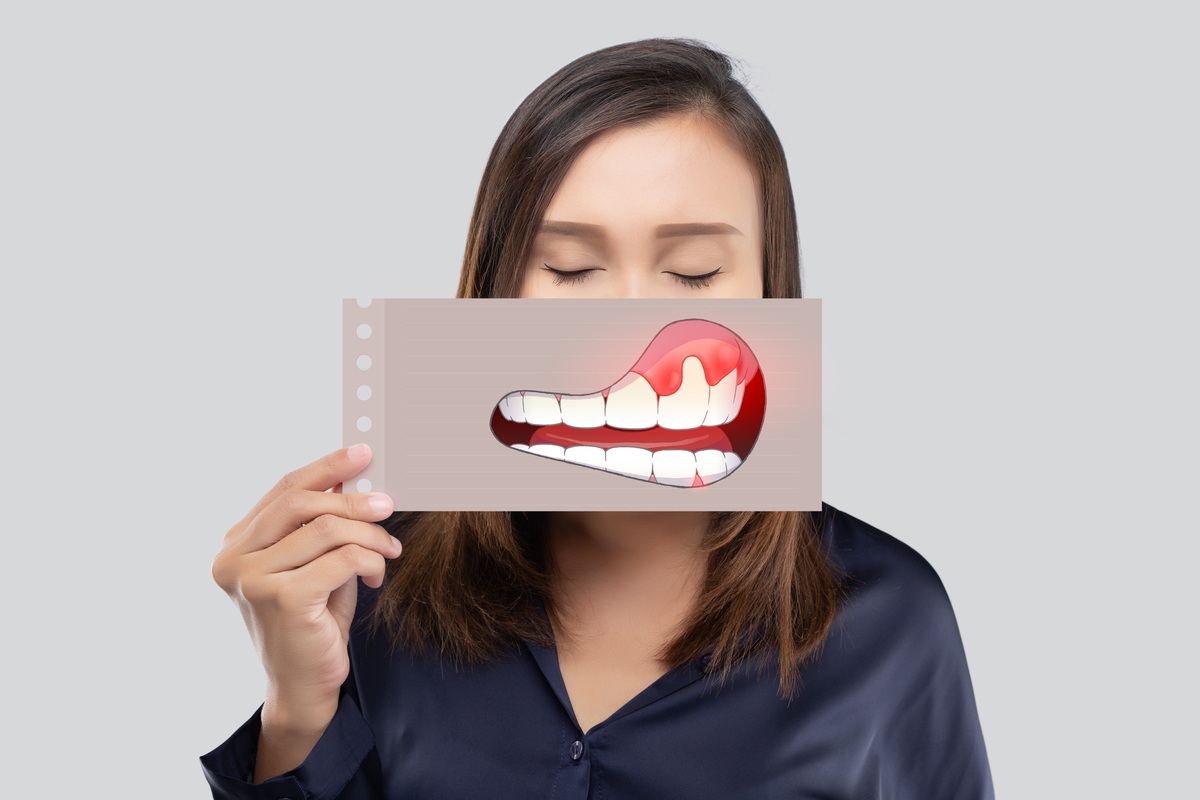 Five Signs You May Need Periodontal Treatment