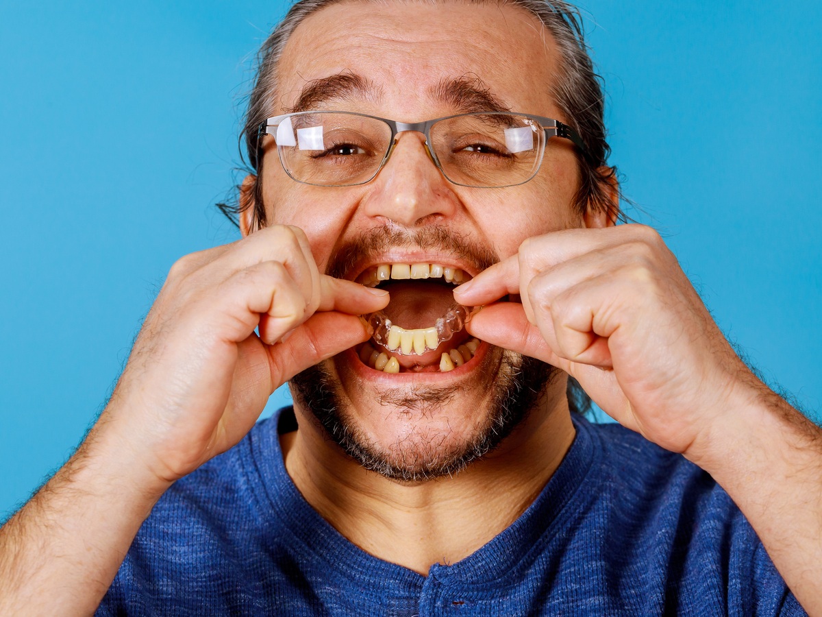 Dental Crowns and Bridges: What’s the Difference and Who Needs Them