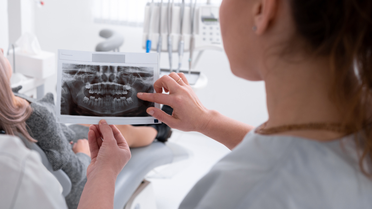 What to Do If You Crack a Tooth: Emergency Dentist in Indian Trail