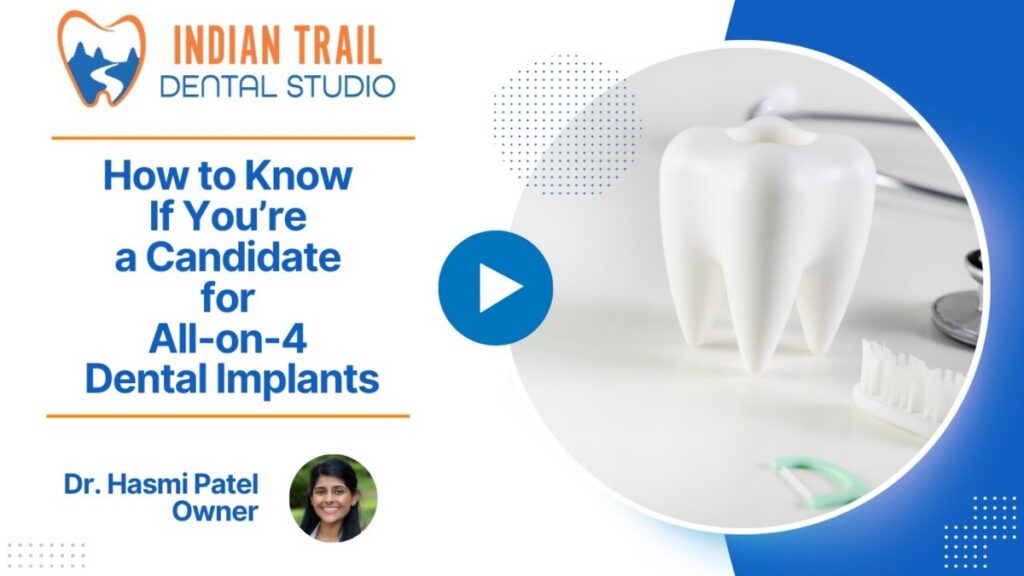 How to Know If You’re a Candidate for All-on-4 Dental Implants