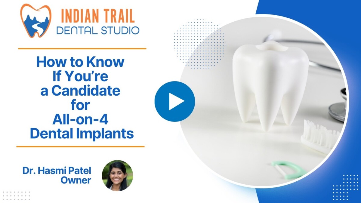 How to Know If You’re a Candidate for All-on-4 Dental Implants