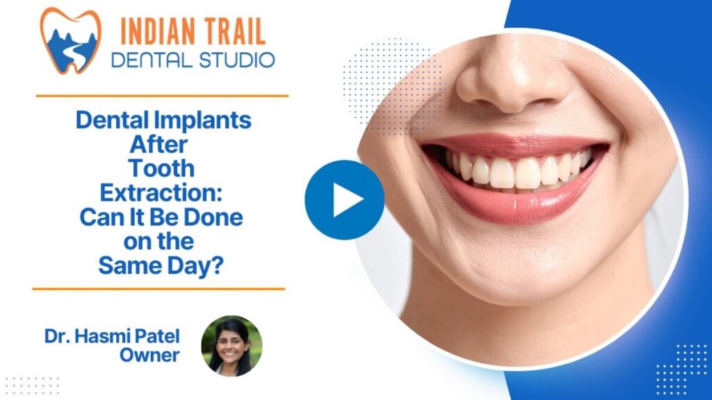 Dental Implants After Tooth Extraction: Can It Be Done on the Same Day?