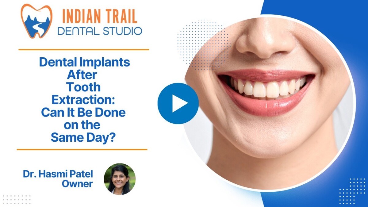 Dental Implants After Tooth Extraction: Can It Be Done on the Same Day?