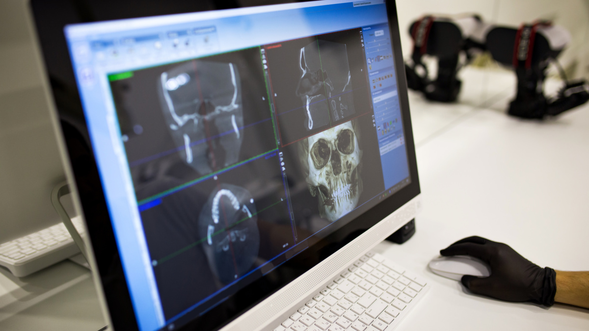 Can TMJ Be Treated Without Surgery? (Indian Trail Treatment Options)