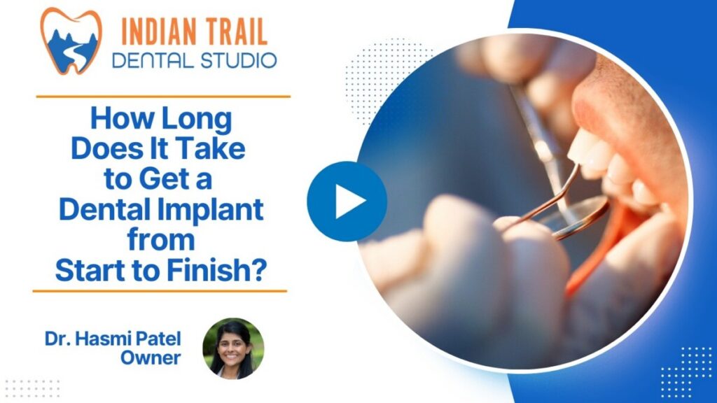 How Long Does It Take to Get a Dental Implant from Start to Finish?