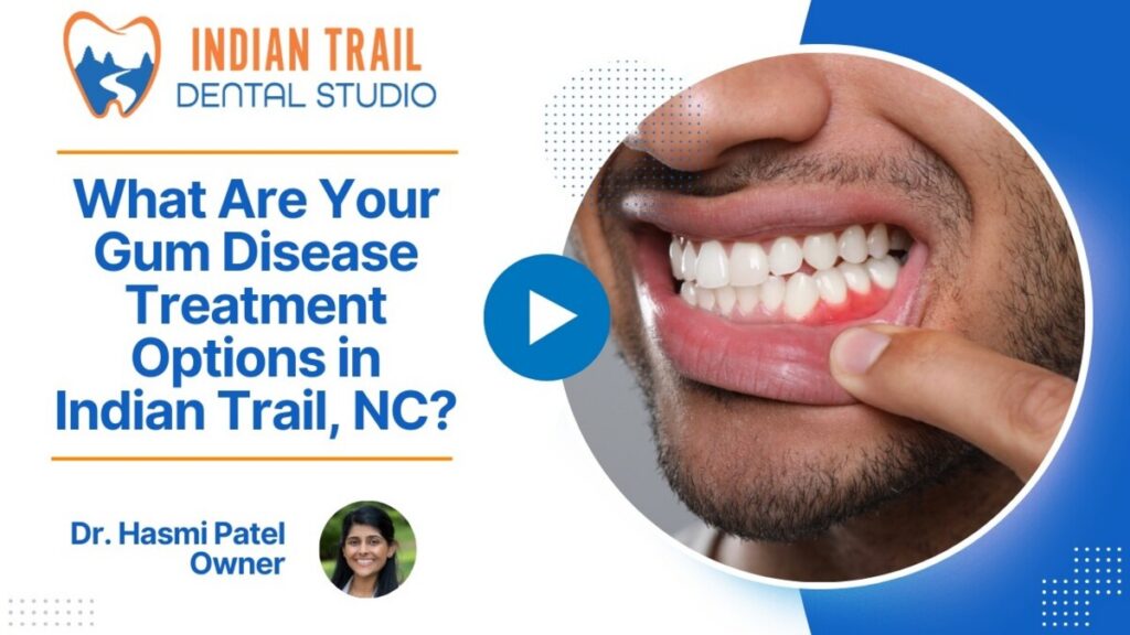 What Are Your Gum Disease Treatment Options in Indian Trail, NC?