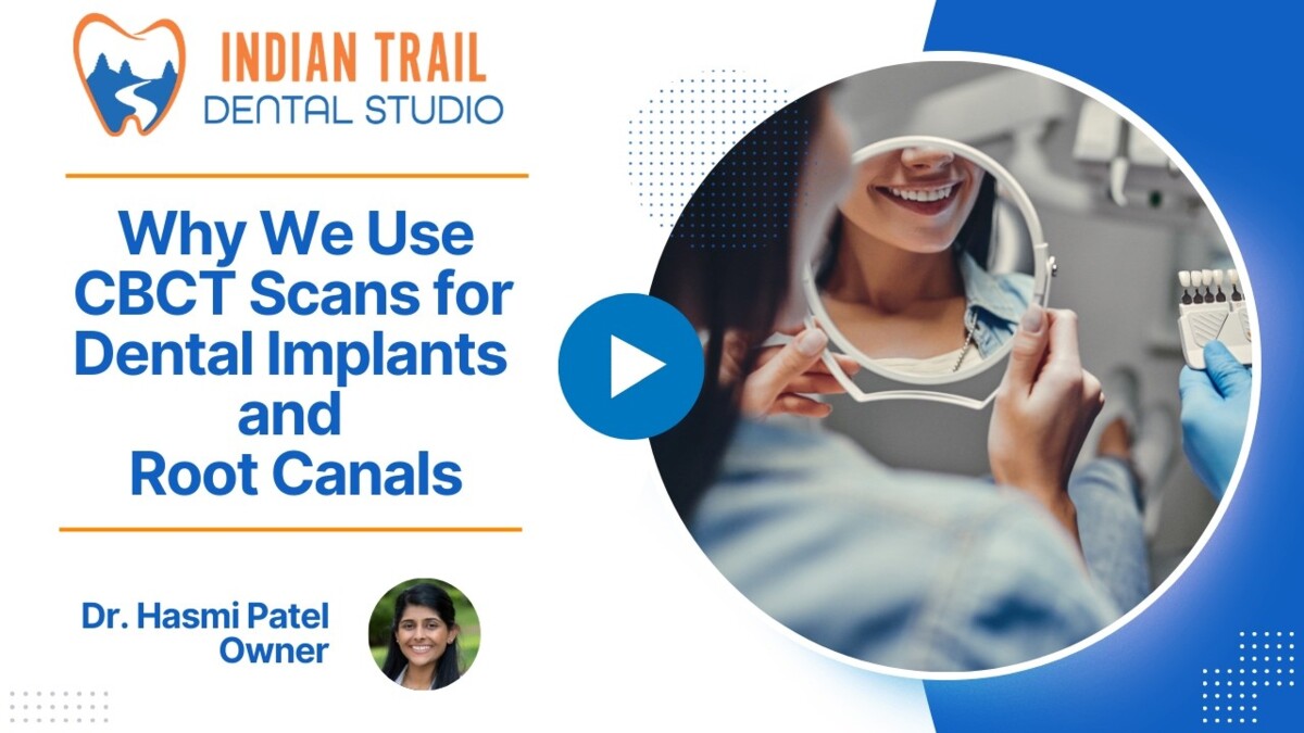 Why We Use CBCT Scans for Dental Implants and Root Canals
