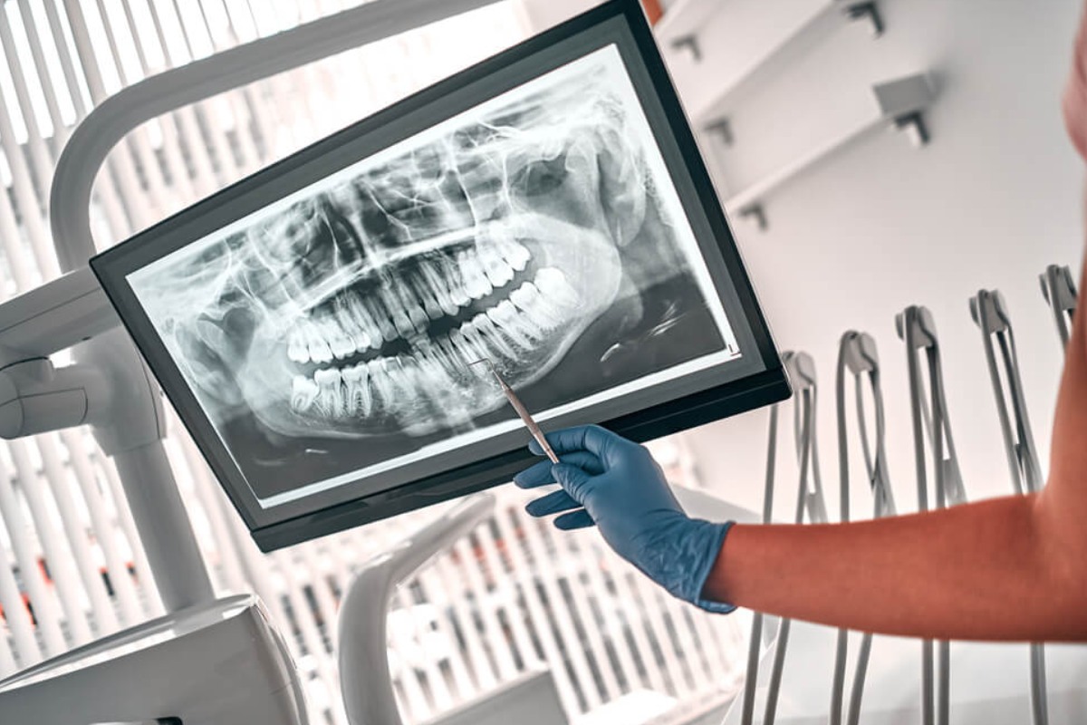 Dental Digital X-Rays with AI Technology background image, Indian Trail Dental Studio