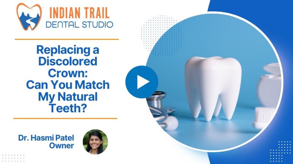 Replacing a Discolored Crown: Can You Match My Natural Teeth?