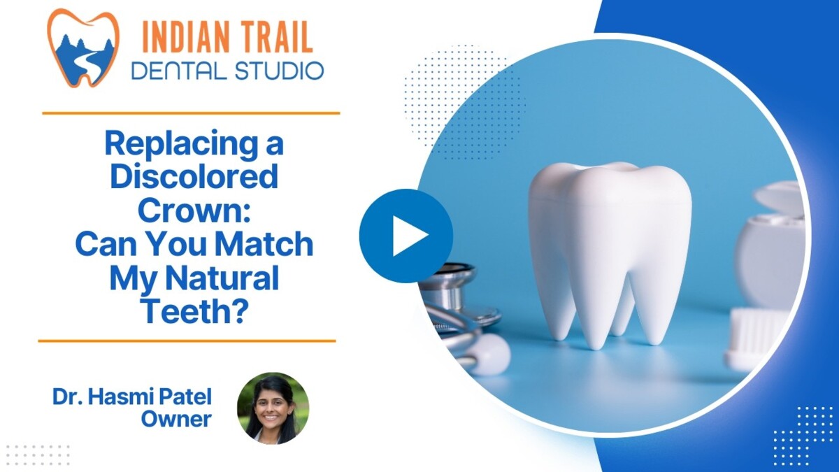 Replacing a Discolored Crown: Can You Match My Natural Teeth?
