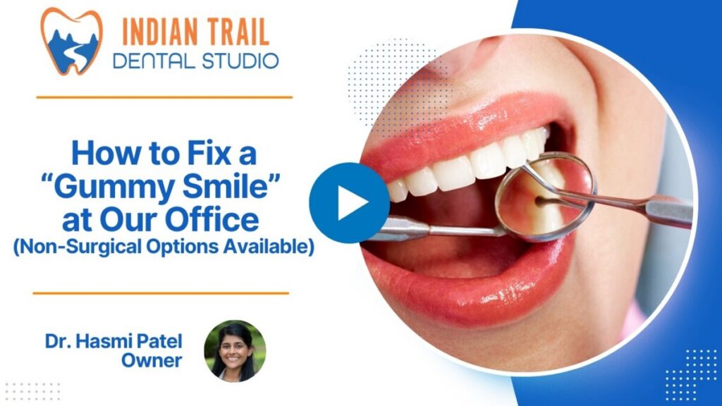 How to Fix a “Gummy Smile” at Our Office (Non-Surgical Options Available)