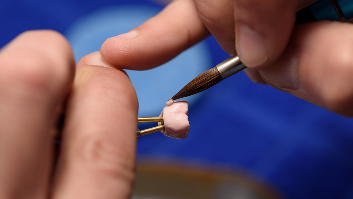Replacing a Discolored Crown: Can You Match My Natural Teeth?