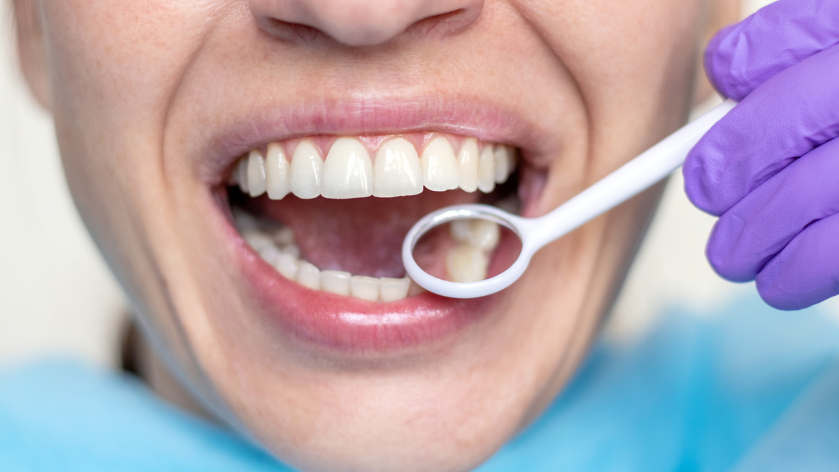 7 Tooth-Friendly Foods That Naturally Strengthen Enamel