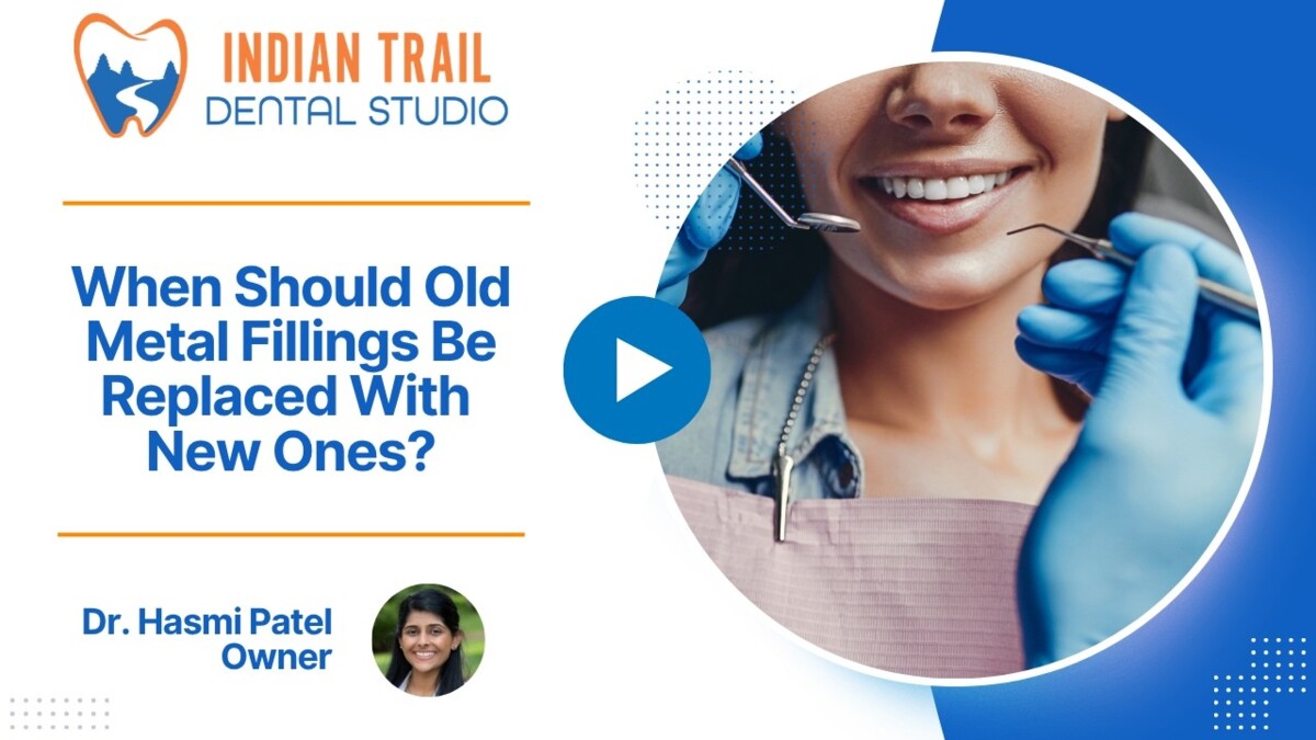 When Should Old Metal Fillings Be Replaced With New Ones?