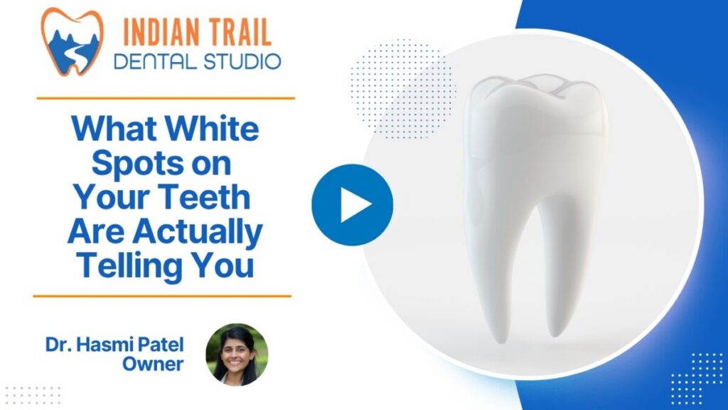What White Spots on Your Teeth Are Actually Telling You